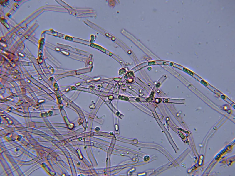 Anomoloma myceliosum 4 - Hifas con aceite-001